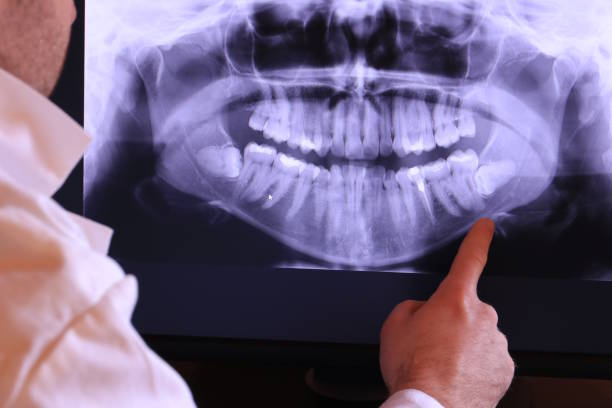 Best Emergency Treatment for Dental Infections or Abscesses in North Royalton, OH